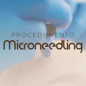 Procedimiento Microneedling